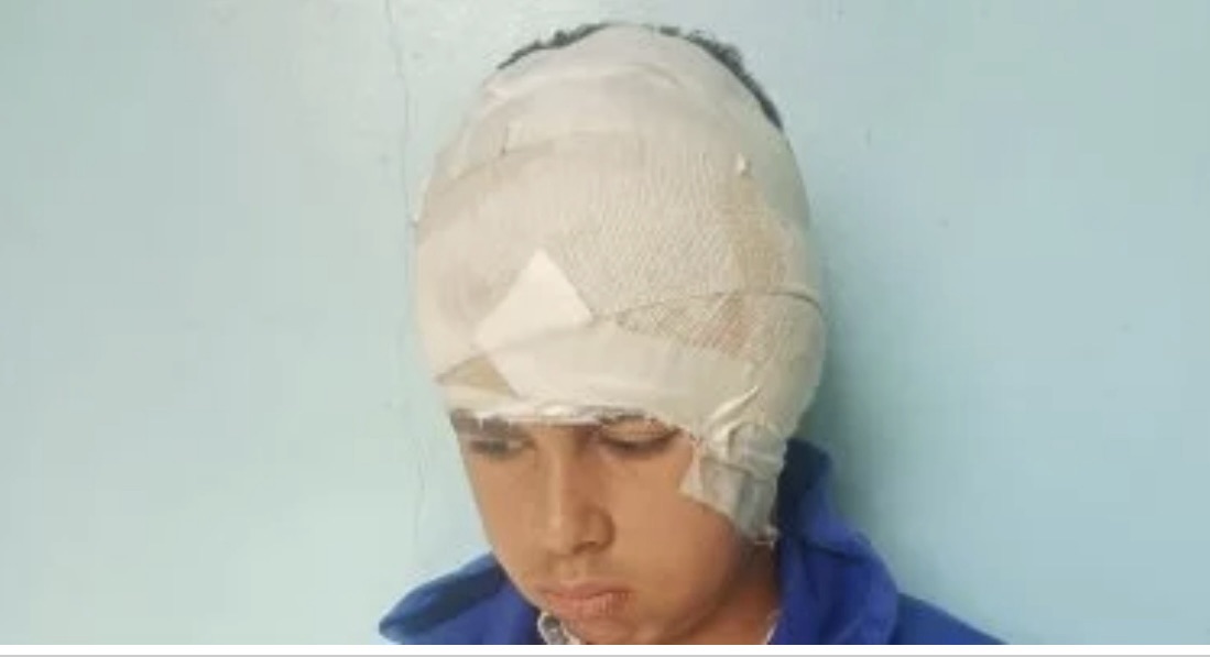 ننشر تفاصيل التقرير الطبي الخاص بتعرض طالب إعدادي لاعتداء بـ”كتر” فى أوسيم