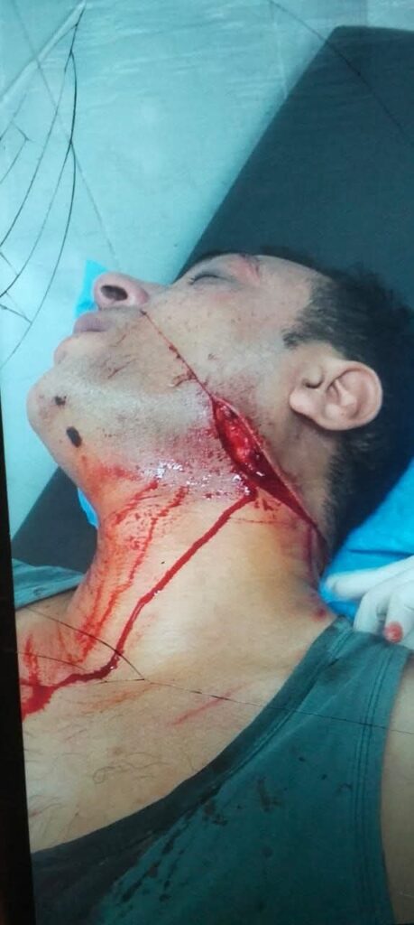 fb_img_17608124698488087187115271726572-459x1024 محامي دمنهور يروي تفاصيل الاعتداء عليه: "كنت هروح فيها وعايز حقي بالقانون"