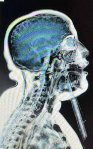 fb_img_1773057306029100725118214402329-188x300 في إطار توجيهات رئيس أمانة المراكز الطبية المتخصصة، الأستاذة الدكتورة/ مها إبراهيم، وإشراف السيد الدكتور/ أحمد سمير فودة