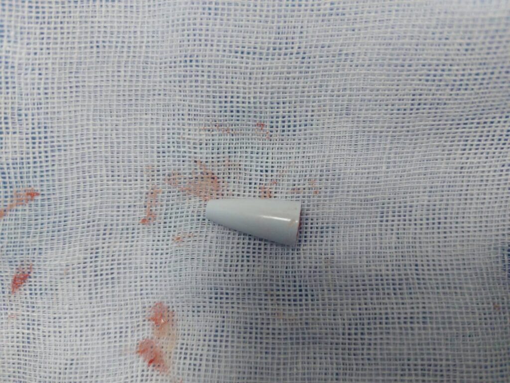 img-20260414-wa00963165232076182970818-1024x768 استخراج جسم غريب من الشعب الهوائية لطفل باستخدام المنظار الشعبي بمستشفى أطفال جامعة المنصورة