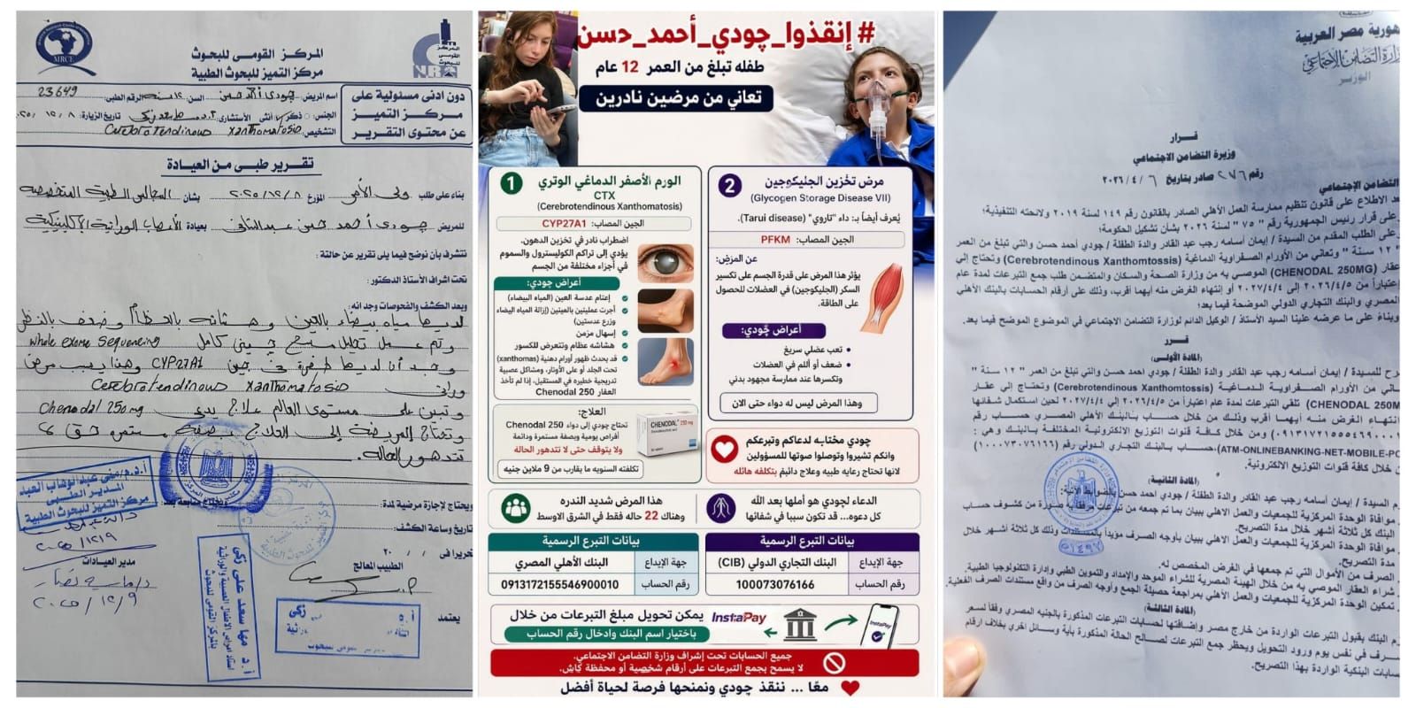 جودي أحمد حسن.. طفلة مصرية تواجه مرضًا نادرًا يهدد حياتها واستغاثة عاجلة لتوفير العلاج