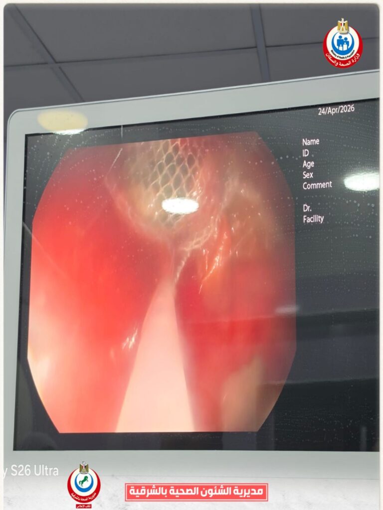 img-20260426-wa00542335805881360575059-768x1024 وكيل وزارة الصحة بالشرقية : استخراج بطارية من معدة طفلة ٤ سنوات  بمستشفى أبو كبير المركزي