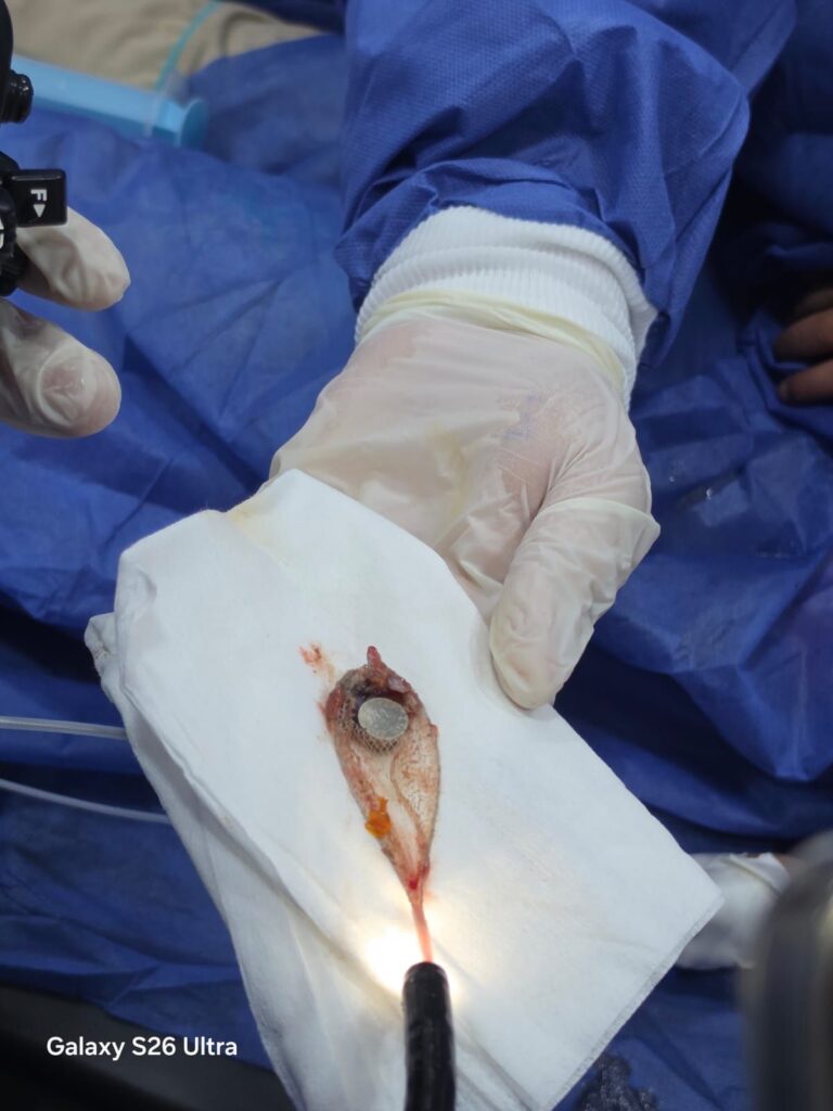 img-20260426-wa00561488407638910306793-768x1024 وكيل وزارة الصحة بالشرقية : استخراج بطارية من معدة طفلة ٤ سنوات  بمستشفى أبو كبير المركزي