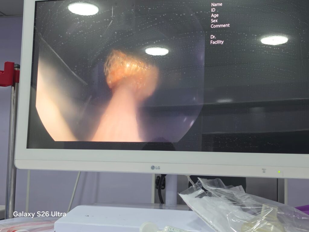 img-20260426-wa00615546420331370670488-1024x768 وكيل وزارة الصحة بالشرقية : استخراج بطارية من معدة طفلة ٤ سنوات  بمستشفى أبو كبير المركزي