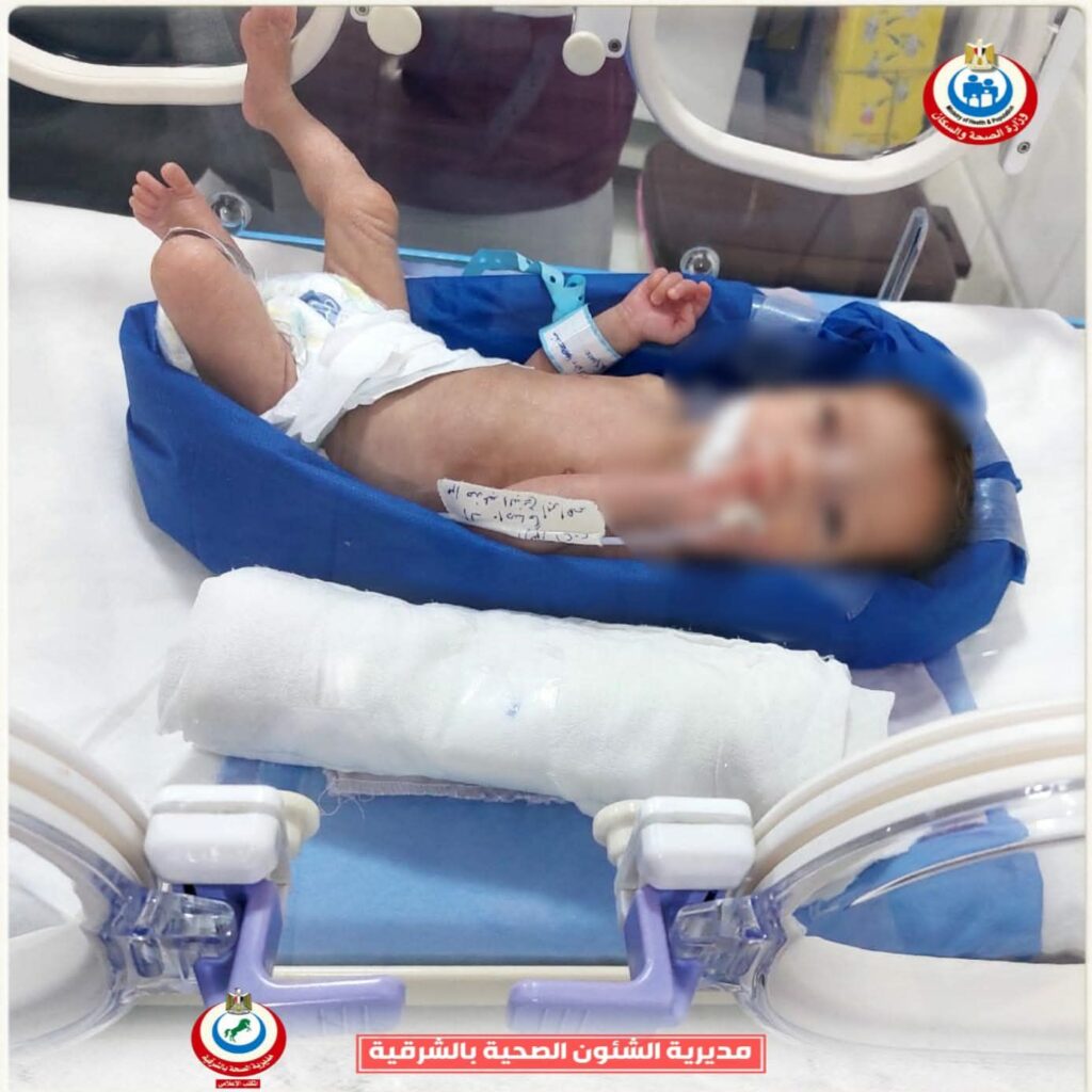messenger_creation_0102e7d7-d903-4f52-93b6-d28f4e1988351811068634954652264-1024x1024 صحة الشرقية : إنقاذ حياة طفلة وزنها ٩٠٠ جرام بحضانات مستشفى الإبراهيمية المركزي
