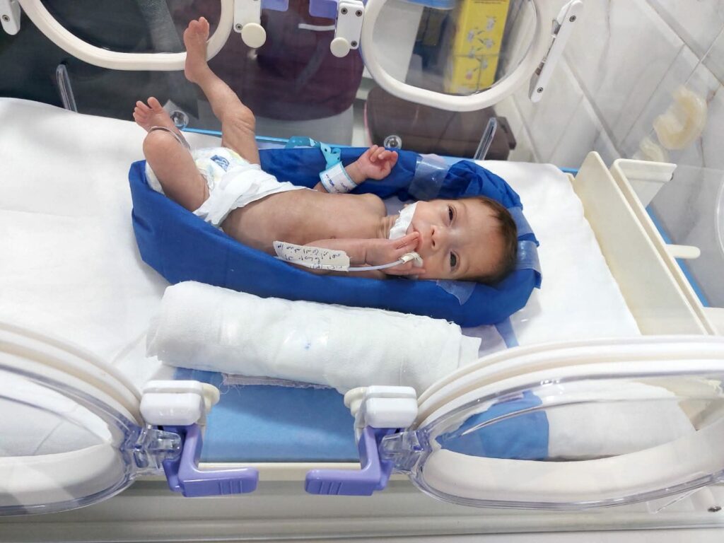 messenger_creation_139f5557-a536-4afc-932d-c944d2b658eb5168144178999611990-1024x768 صحة الشرقية : إنقاذ حياة طفلة وزنها ٩٠٠ جرام بحضانات مستشفى الإبراهيمية المركزي