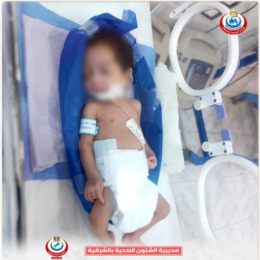 messenger_creation_574cecb9-7754-4fd4-a7e9-e80d78ed460f5682542797257271547-1024x1024 صحة الشرقية : إنقاذ حياة طفلة وزنها ٩٠٠ جرام بحضانات مستشفى الإبراهيمية المركزي