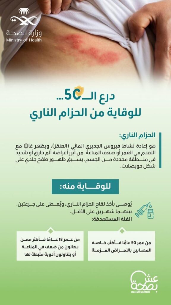 img-20260505-wa00882999621061811569385-576x1024 تواصل فعاليات التوعية ضد مرض الحزام الناري تزامنا مع الأسبوع العالمي للتحصينات