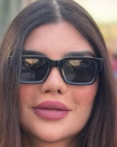 img-20260517-wa00616003497505252270230-239x300 جويل بدر تكشف تفاصيل تشوّه أنفها بعد عملية تجميل وتثير حالة من التفاعل