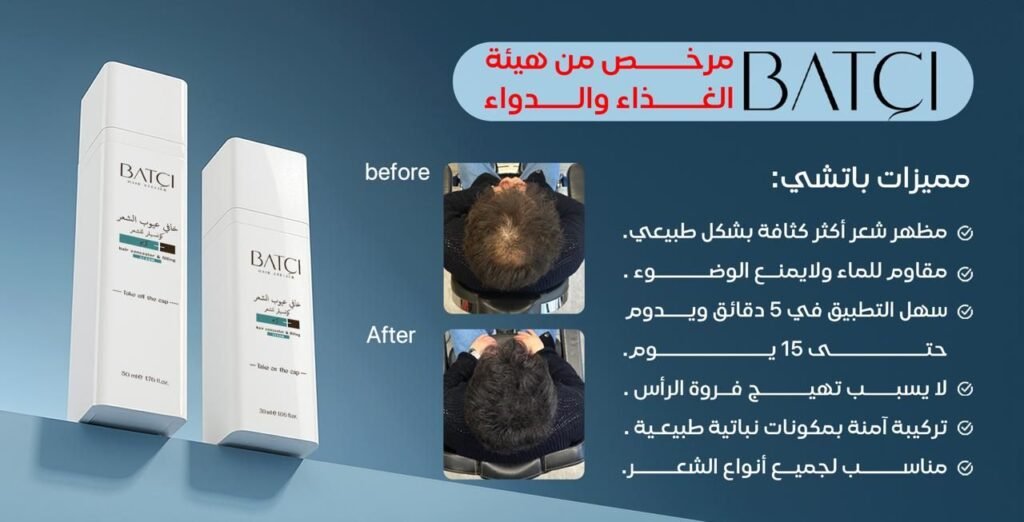 img-20260616-wa01547207779883613024168-1024x522 باتشي هير: منتجات إخفاء الشعر الخفيف تواصل توسعها داخل قطاع العناية بالمظهر في السعودية